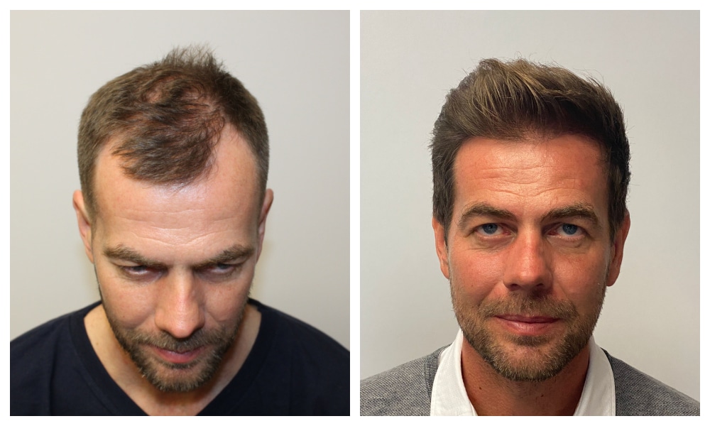 3183-hairs-Csaba