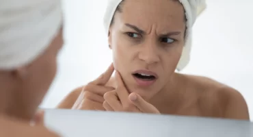 is-your-skincare-routine-damaging-your-skin-barrier درمان جوش و آكنه