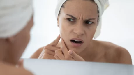 is-your-skincare-routine-damaging-your-skin-barrier درمان جوش و آكنه